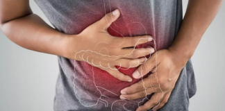 Síndrome de intestino irritable y TOC, a la lista de aplicables para cannabis medicinal Síndrome de intestino irritable y TOC, a la lista de aplicables para cannabis medicinal