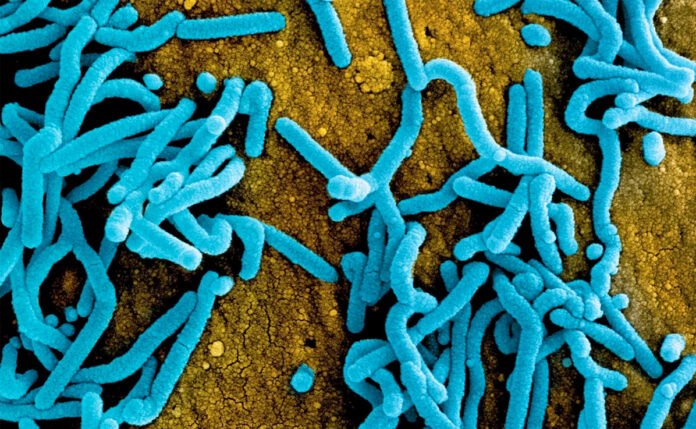 Brote de virus de Marburgo urge desarrollo de vacunas