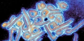 Nueve muertos en Guinea Ecuatorial por virus de Marburgo Nueve muertos en Guinea Ecuatorial por virus de Marburgo