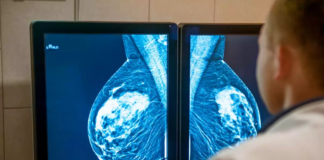 Proyecto de ley apunta a bajar costos tras exámenes para detectar cáncer de mama Proyecto de ley apunta a bajar costos tras exámenes para detectar cáncer de mama