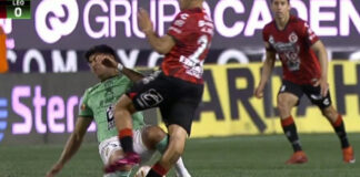 Terrible lesión de Carlos Valenzuela, jugador de Xolos Terrible lesión de Carlos Valenzuela, jugador de Xolos