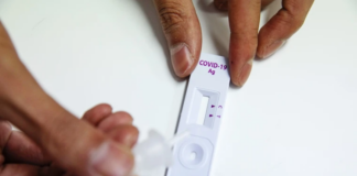 Más de medio millón de pruebas de COVID-19 de Roche y SD Biosensor deben desecharse Más de medio millón de pruebas de COVID-19 de Roche y SD Biosensor deben desecharse