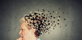 ¿Por qué la mayor cantidad de casos de Alzheimer no está en Twin Cities? ¿Los hispanos son más propensos? ¿Por qué la mayor cantidad de casos de Alzheimer no está en Twin Cities?