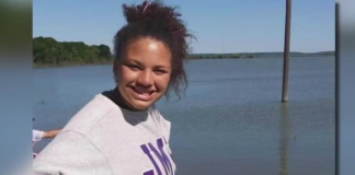 Una adolescente de Dallas sufrió quemaduras en el 90% de su cuerpo en accidente familiar Una adolescente de Dallas sufrió quemaduras en el 90% de su cuerpo en accidente familiar