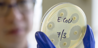 Investigan brote de E. coli con quesos que golpeó a Texas y otros tres estados Investigan brote de E. coli con quesos que golpeó a Texas y otros tres estados