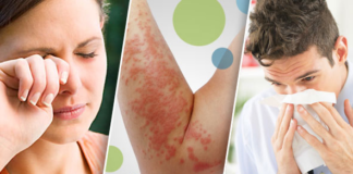 El clima cálido sorprende a los minesotanos y las alergias se adelantan El clima cálido sorprende a los minesotanos y las alergias se adelantan