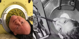 Murió Paul Alexander, el hombre que vivió en un pulmón de acero durante la mayor parte de su vida Murió Paul Alexander, el hombre que vivió en un pulmón de acero durante la mayor parte de su vida