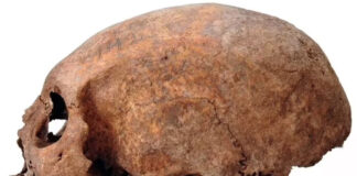 Estudio sugiere que los vikingos hacían cirugías donde alargaban cráneos Estudio sugiere que los vikingos hacían cirugías donde alargaban cráneos