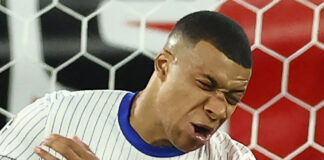 Kylian Mbappé se fracturó la nariz y preocupa a Francia y al Real Madrid Kylian Mbappé se fracturó la nariz y preocupa a Francia y al Real Madrid