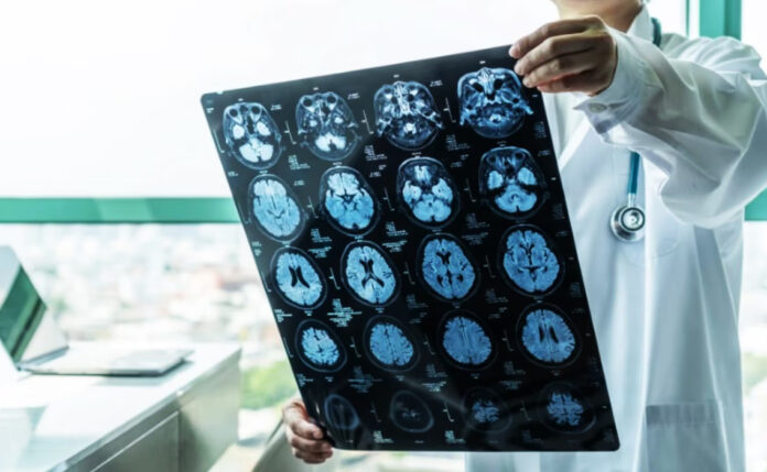 EEUU aprueba medicamento de la farmacéutica Eli Lilly para tratar el alzhéimer