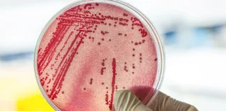 Cuatro playas de Minneapolis cierran debido a bacteria Cuatro playas de Minneapolis cierran debido a bacteria