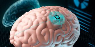 Neuralink retomará la instalación de implantes cerebrales en humanos Neuralink retomará la instalación de implantes cerebrales en humanos