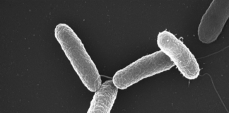 Se reportan casos de Salmonella en Minnesota y Wisconsin Casos de Salmonella en Minnesota