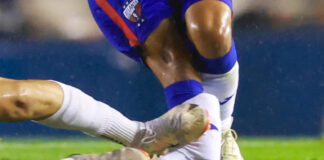 El Hobbit Bermúdez fue enviado al hospital con una brutal agresión El Hobbit Bermúdez fue enviado al hospital con una brutal agresión