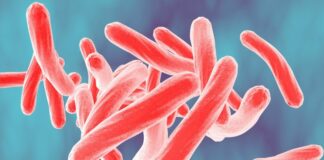 Caso de tuberculosis confirmado en la preparatoria Lakeville South Caso de tuberculosis activa confirmado en la preparatoria Lakeville South, pero autoridades aseguran que no hay más riesgos