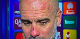 Pep Guardiola habla sobre sus autolesiones: “Hay que buscar ayuda” Pep Guardiola habla sobre sus autolesiones: "Hay que buscar ayuda"