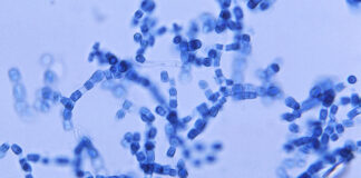 Esporas microscópicas de un hongo son la nueva amenaza de supermicrobio Esporas microscópicas de un hongo son la nueva amenaza de supermicrobio