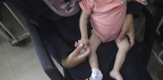 Mueren 21 niños por desnutrición y hambre en las últimas 72 horas, en Gaza Mueren 21 niños por desnutrición y hambre en las últimas 72 horas, en Gaza