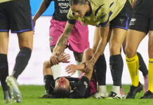 Charlyn Corral sufre escalofriante herida en Duelo de Estrellas vs Barcelona Charlyn Corral sufre escalofriante herida en Duelo de Estrellas vs Barcelona