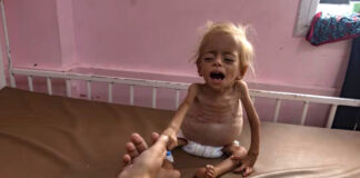 La Unión Europea, Reino Unido y Japón piden acción urgente ante la hambruna en Gaza La Unión Europea, Reino Unido y Japón piden acción urgente ante la hambruna en Gaza