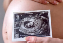 Relacionan la contaminación del aire con cambios en el desarrollo cerebral fetal Relacionan la contaminación del aire con cambios en el desarrollo cerebral fetal