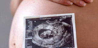 Relacionan la contaminación del aire con cambios en el desarrollo cerebral fetal Relacionan la contaminación del aire con cambios en el desarrollo cerebral fetal