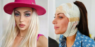 Bárbara Jankavski, influencer brasileña, murió tras someterse a 27 cirugías estéticas Bárbara Jankavski, influencer brasileña, murió tras someterse a 27 cirugías estéticas