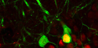 Recaer en el consumo de cocaína no es falta de voluntad, la droga reconfigura el cerebro Recaer en el consumo de cocaína no es falta de voluntad, la droga reconfigura el cerebro